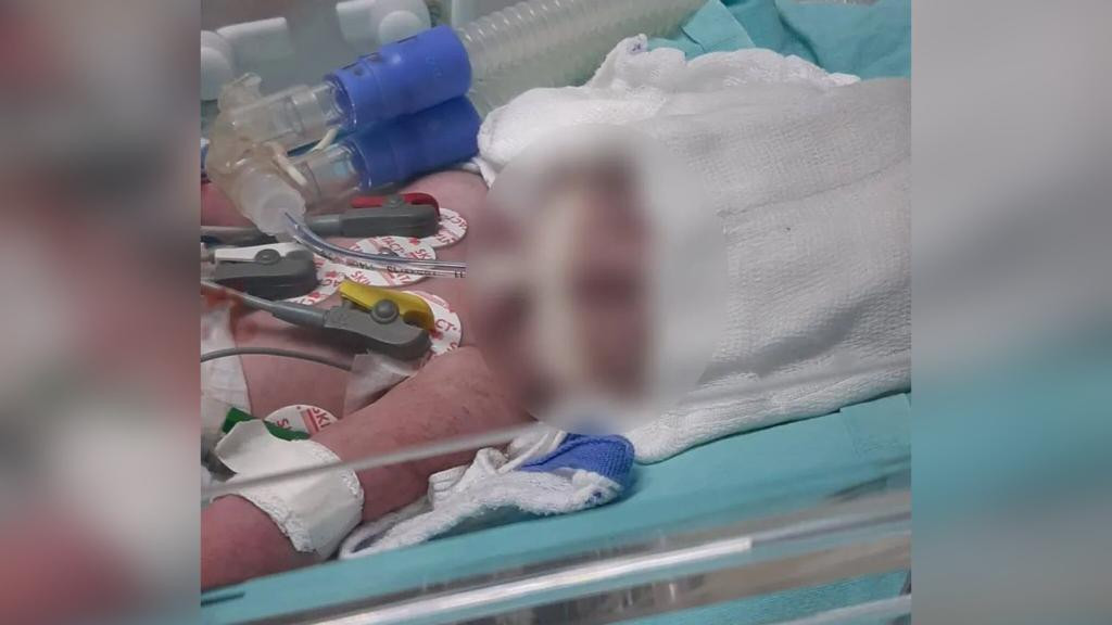 Pais são indiciados por morte de bebê pisoteado em SC: "cabeça estourada"