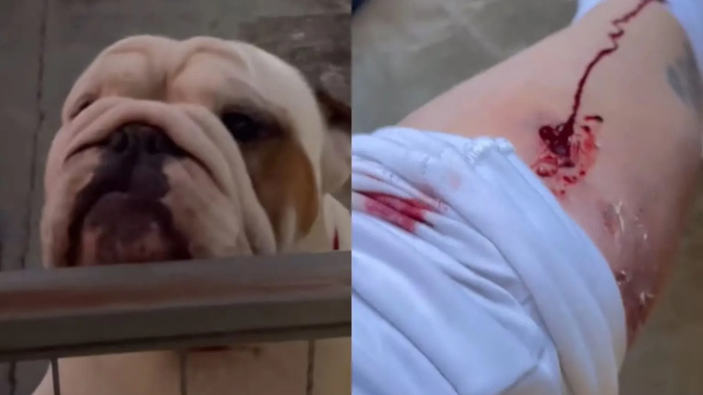 Catarinense é brutalmente atacada por seu próprio cão de estimação: "corre, Margarete"