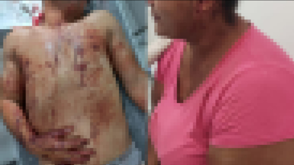 Mulher é agredida a tijoladas em Bombinhas e, para se defender, esfaqueia marido