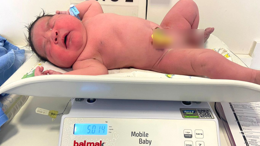 Bebê gigante nasce com mais de 5 kg em SC